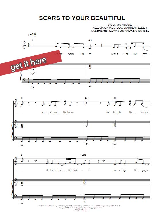 Alessia Cara Scars To Your Beautiful Sheet Music, Piano Notes, Chords